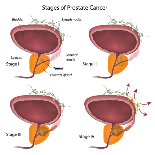 oncologist consultants