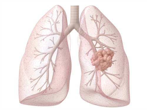 oncologist consultants