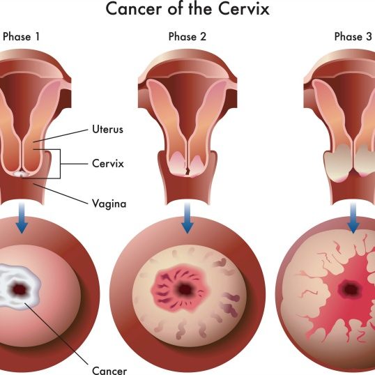 oncologist consultants