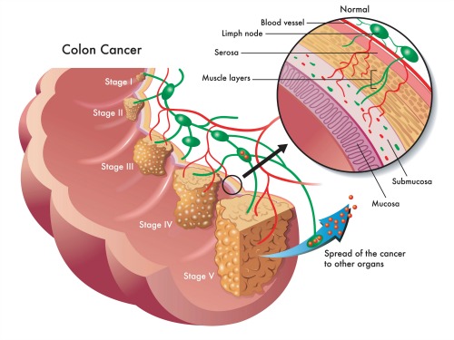 oncologist consultants