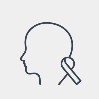oncologist consultants