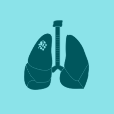 oncologist consultants