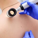 What is melanoma – Premier Oncology Consultants, Katy TX