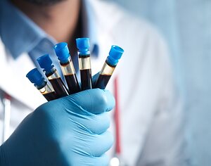 Blood test for cancer – Premier Oncology Consultants, Katy TX