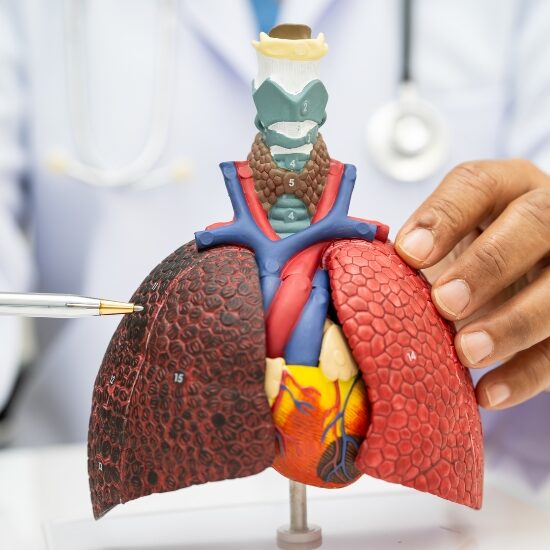 lung cancer symptoms