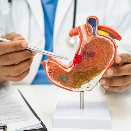 stomach cancer