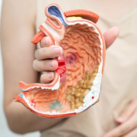 bowel cancer risk factors Symptoms of Bowel Cancer in a Woman | Early Warning Signs Guide