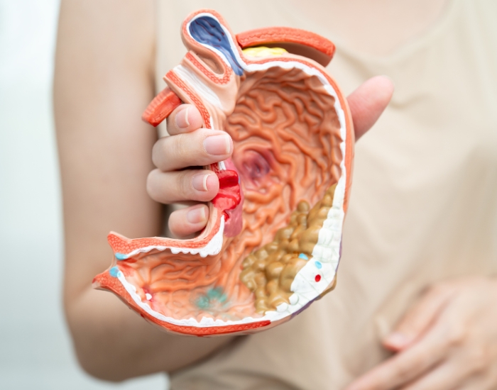 Symptoms of Bowel Cancer in a Woman | Early Warning Signs Guide