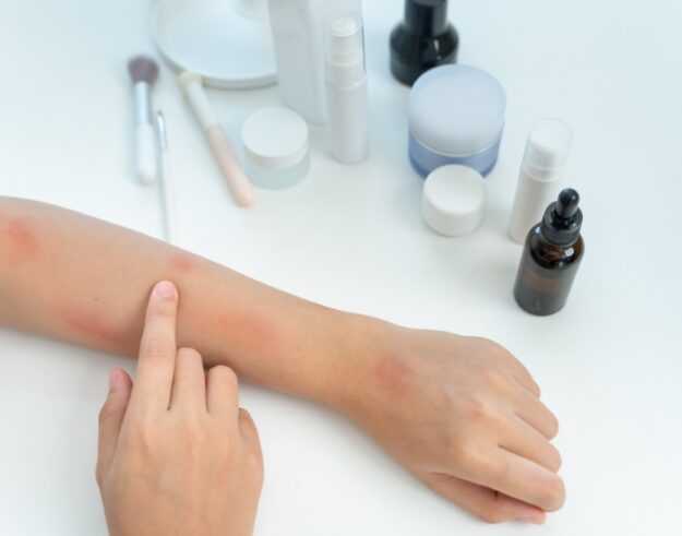 What Cancer Causes Itchy Skin? | Itching Cancer Signs