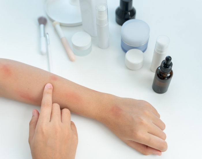 What Cancer Causes Itchy Skin? | Itching Cancer Signs