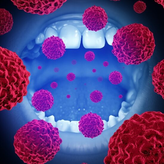 early signs of mouth cancer What Does Mouth Cancer Look Like? | Early Visual Signs Explained