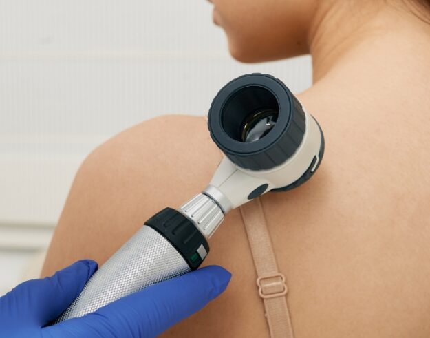 Skin Cancer Symptoms | Early Warning Signs to Watch