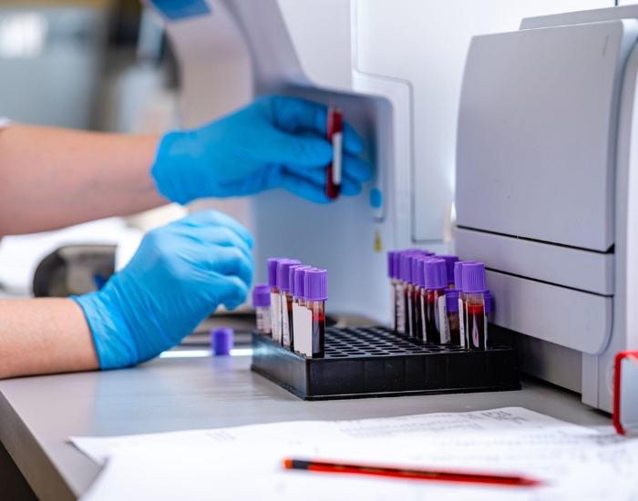 abnormal CBC hematologist abnormal blood count