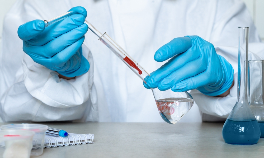 Abnormal blood test evaluation by a hematologist