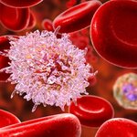 elevated platelets and cancer