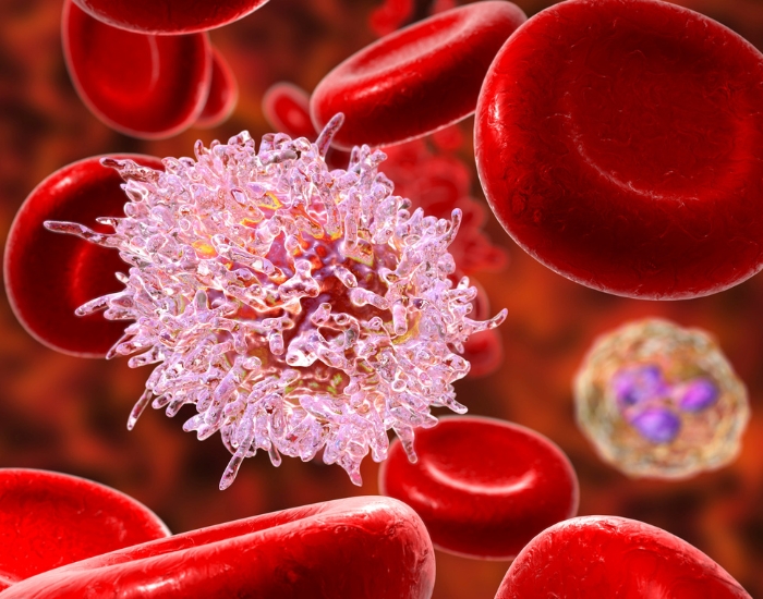 high platelet count elevated platelets and cancer