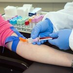 Low WBC Count: Does It Mean Cancer? | Premier Oncology